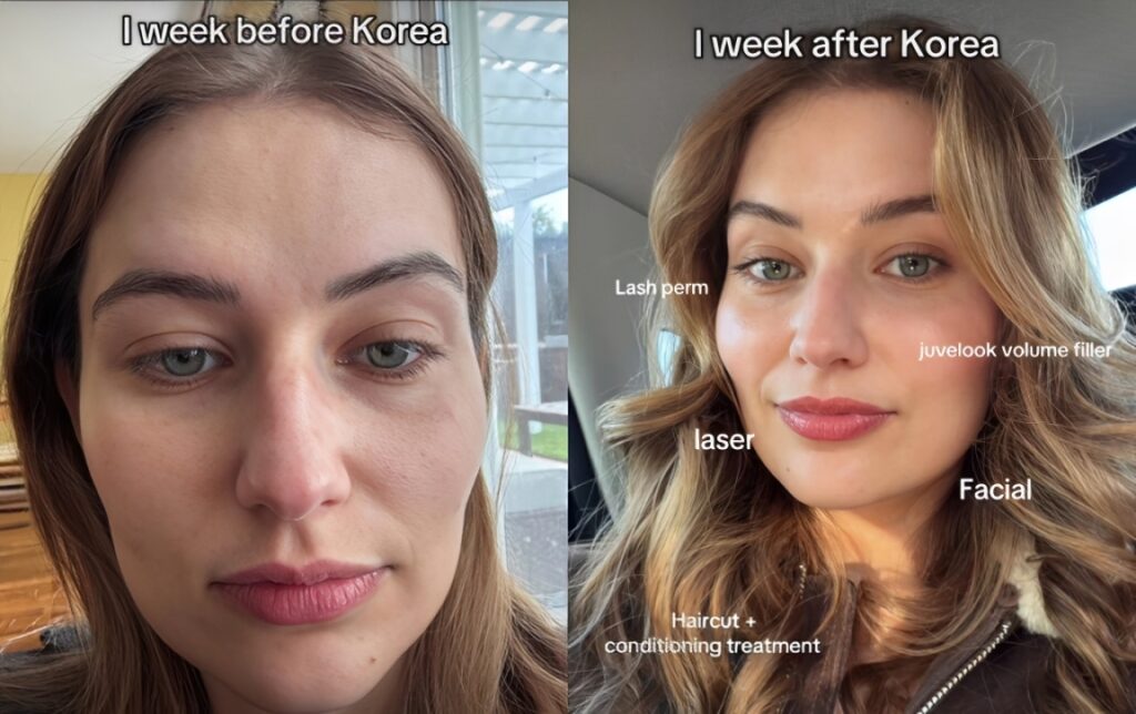 Iris 31 an Icelander who traveled to Korea